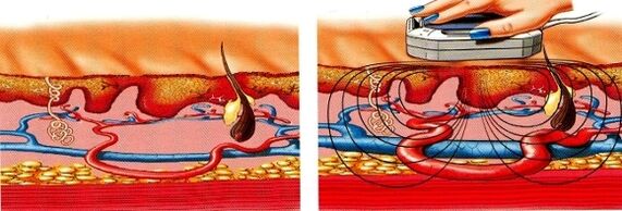 si tus piernas se adormecen